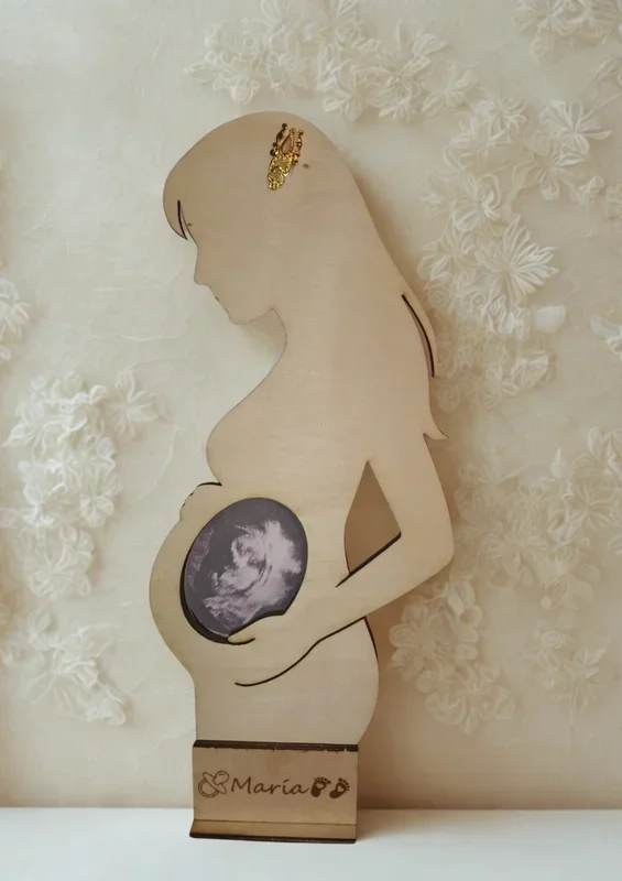 MARCOS DE ECOGRAFÍA PERSONALIZADOS